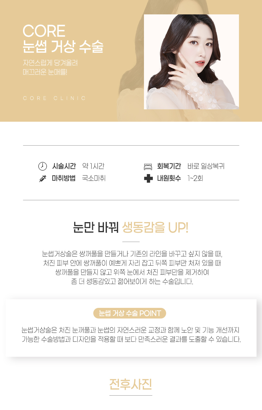 눈썹거상술