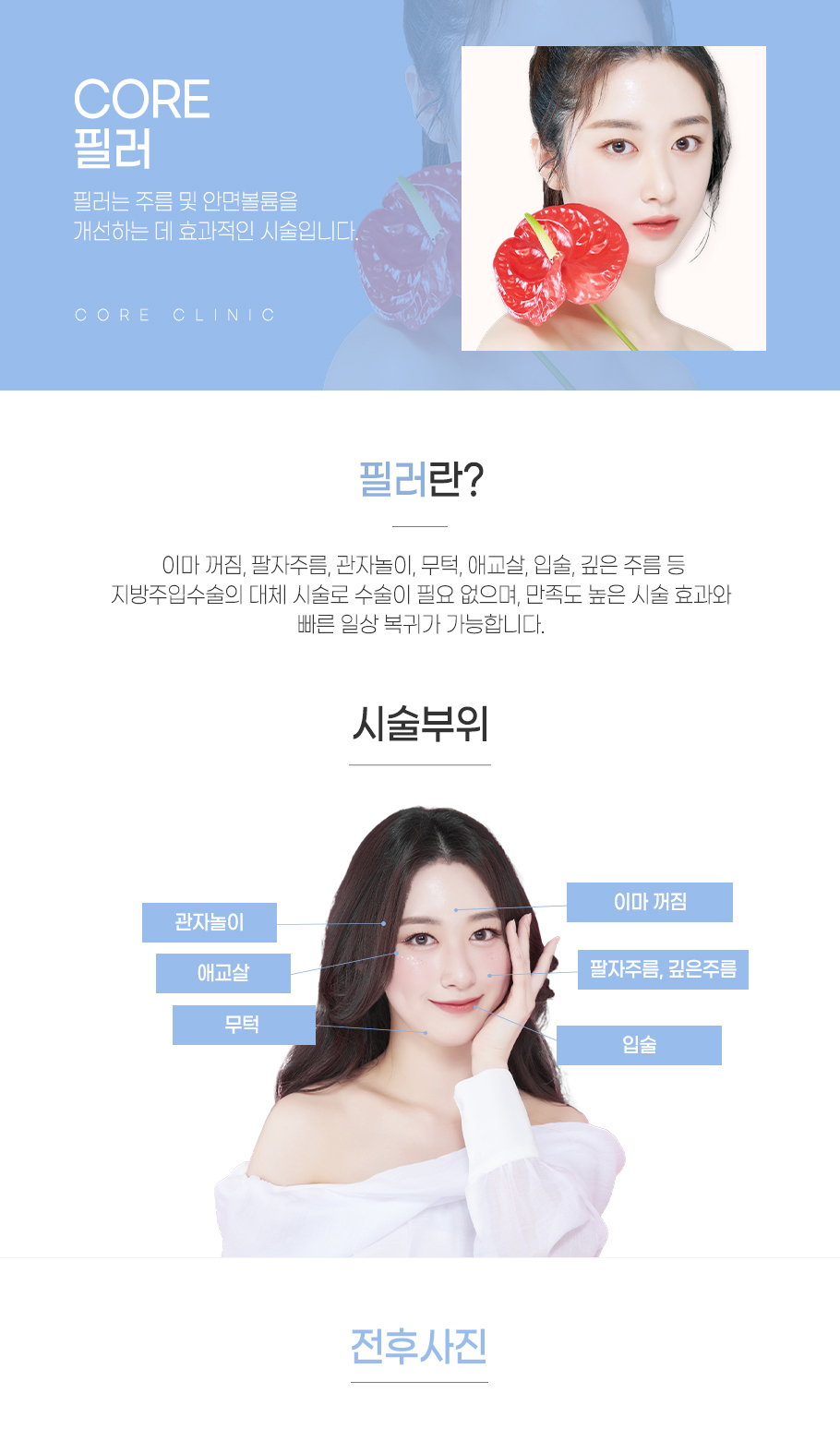 필러