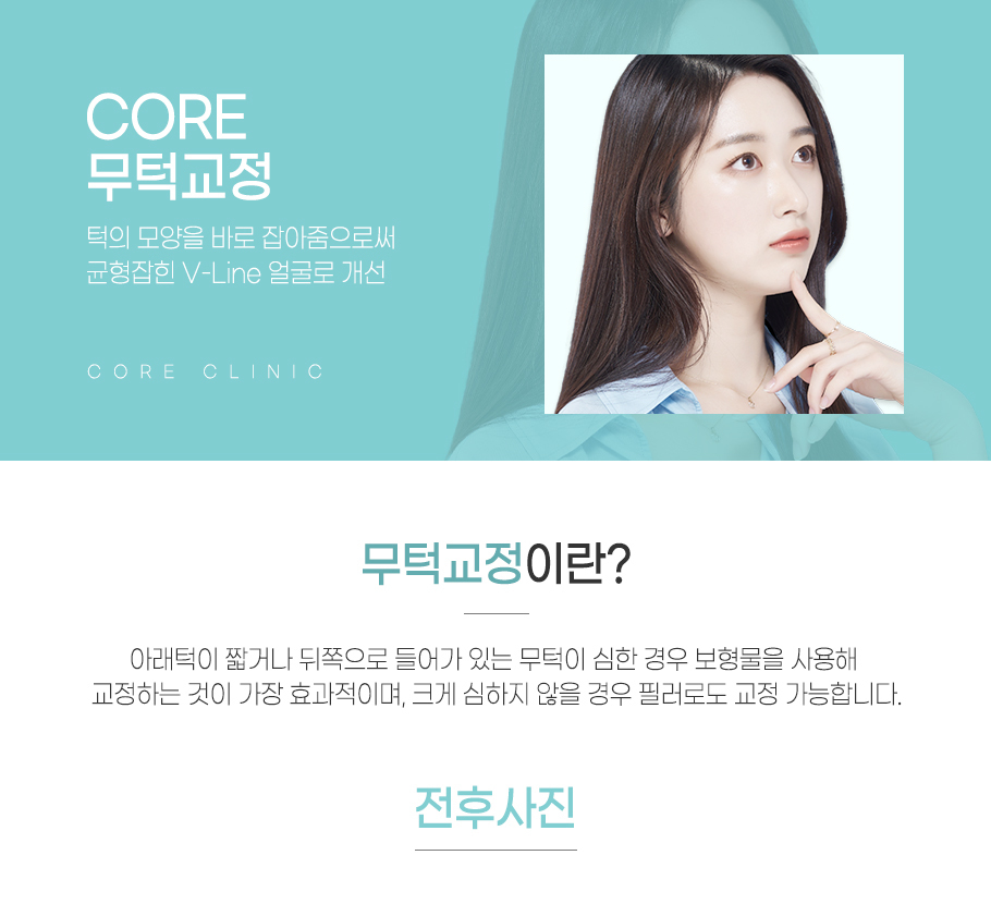 무턱교정