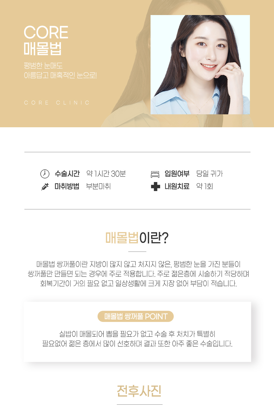 매몰법