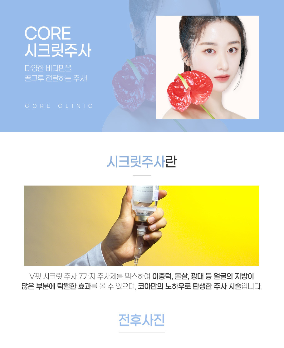 시크릿주사