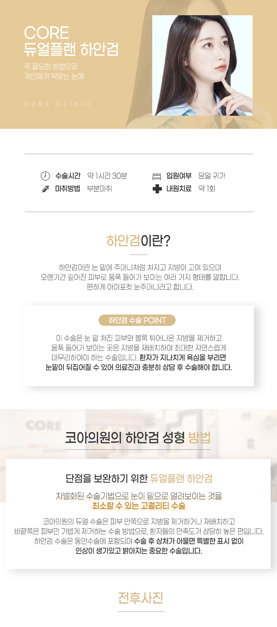 하안검수술