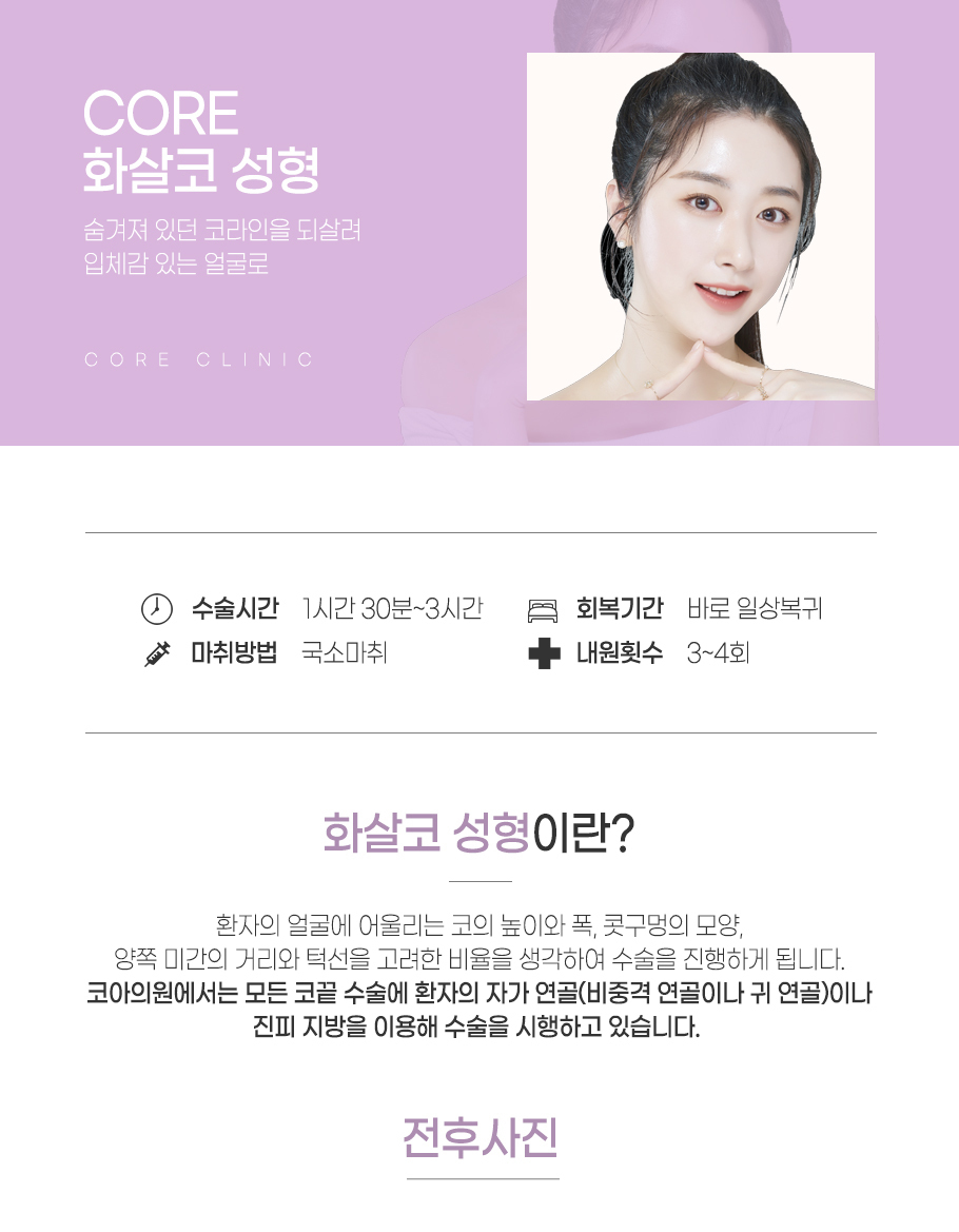 코끝,콧망울 성형
