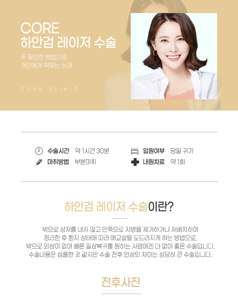 하안검레이저수술